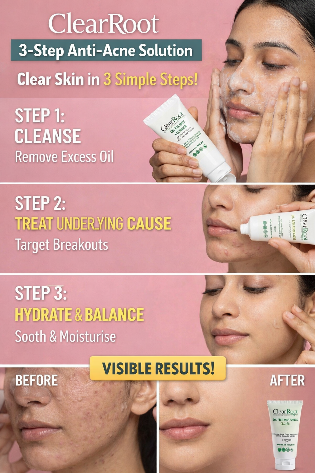 ClearRoot Clear Skin in 3 Simple Steps
