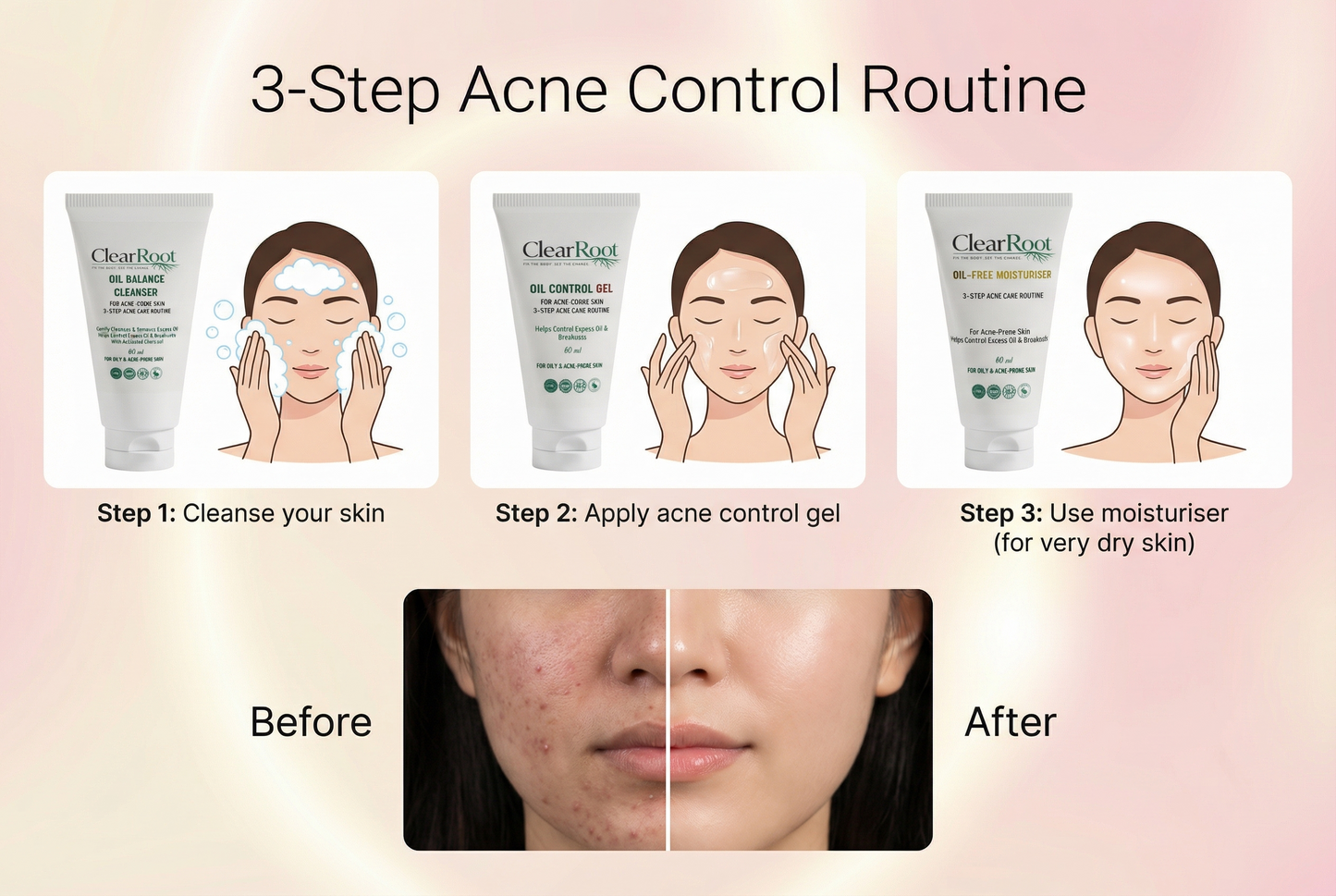 ClearRoot Clear Skin in 3 Simple Steps
