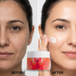 Face Lifting  Anti Aging Face Cream